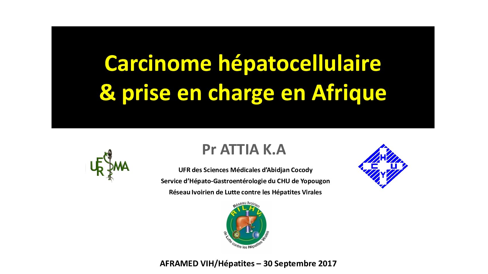 Carcinome hépatocellulaire et prise en charge en Afrique