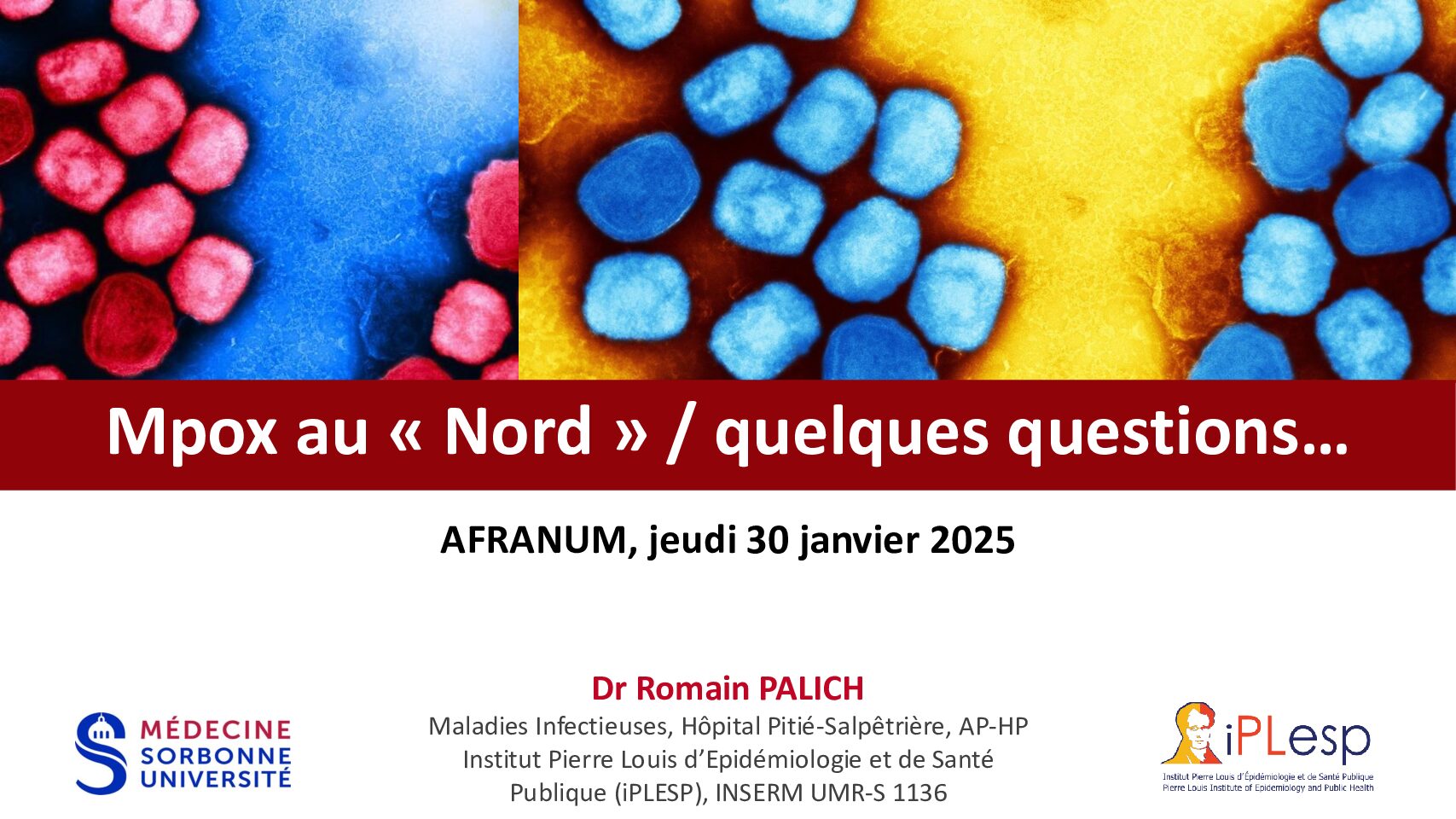 Mpox au « Nord » / quelques questions…